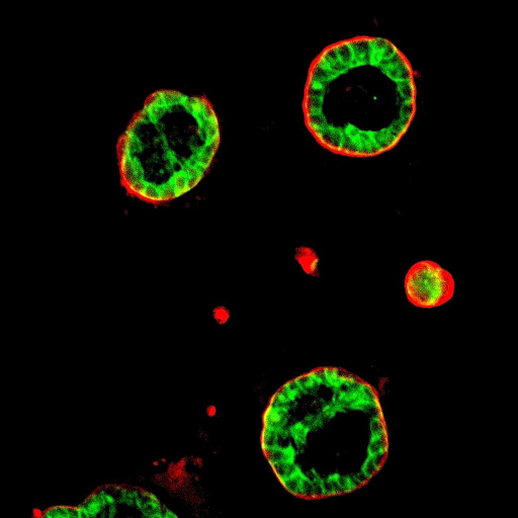 Non-transformed Breast Epithelial Organoids